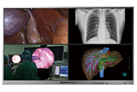 手術(shù)室顯示器